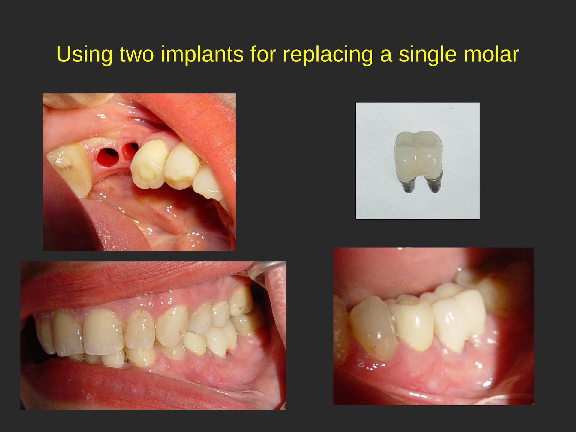 San Jose Cosmetic Dentist