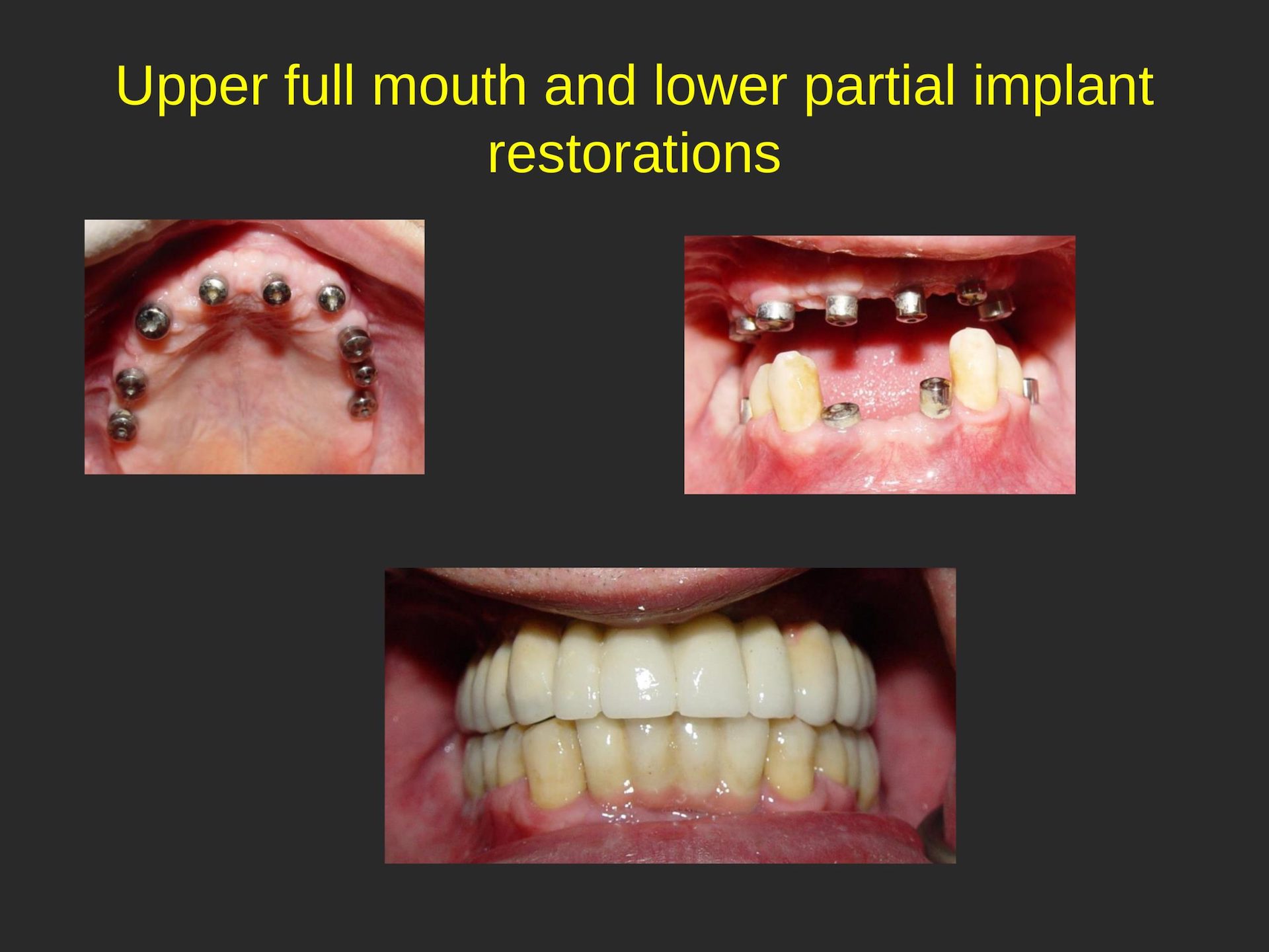 Family Dentist in San Jose