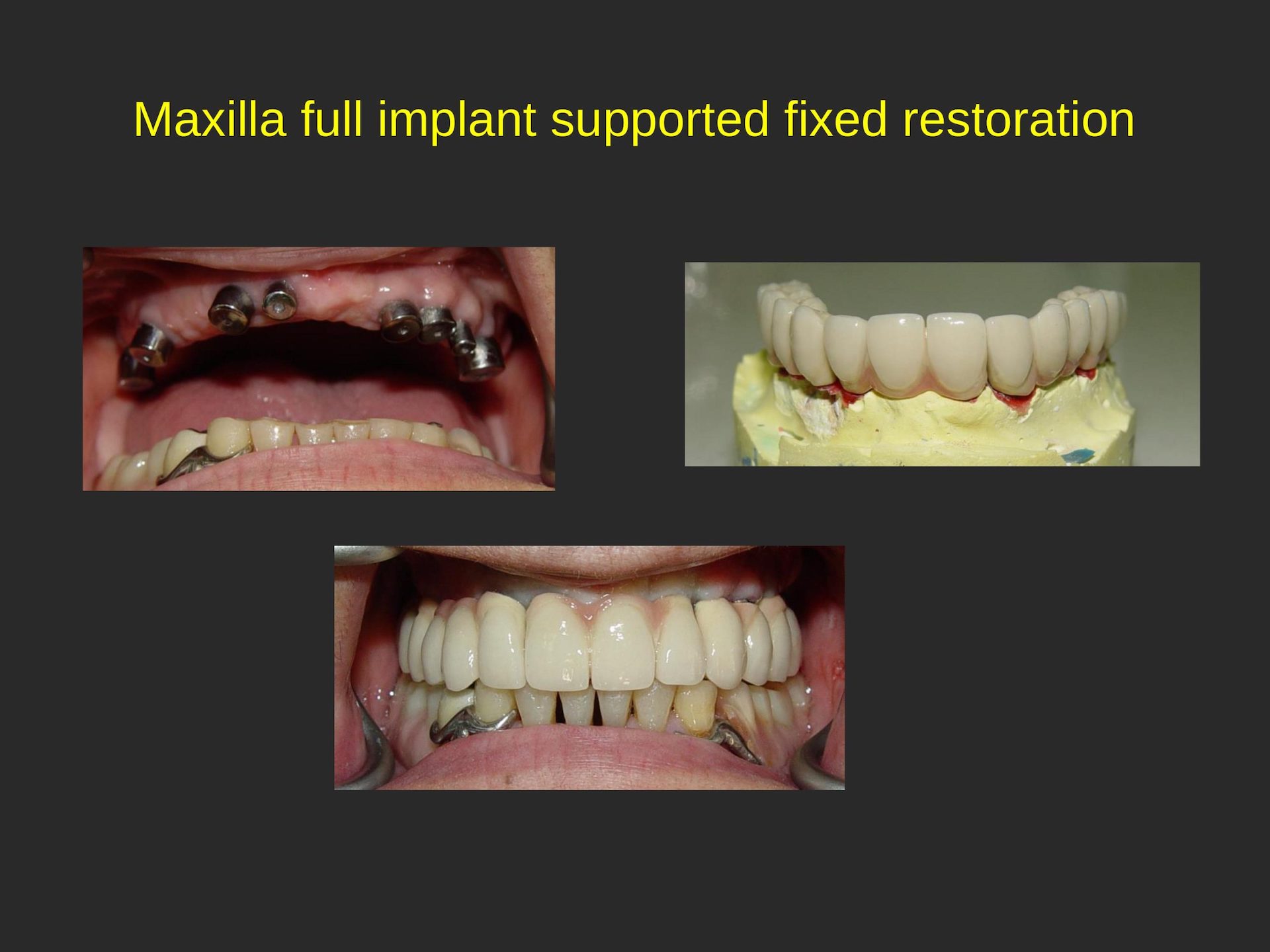 Cosmetic Dental Office in San Jose