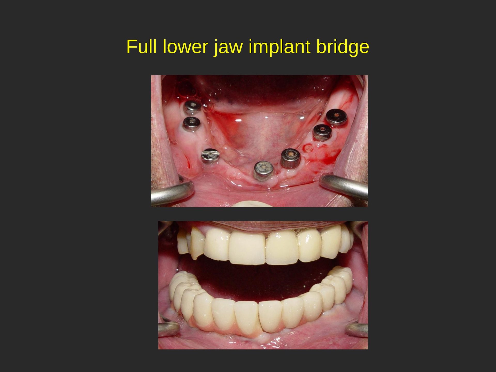 Cosmetic Dental Office in San Jose