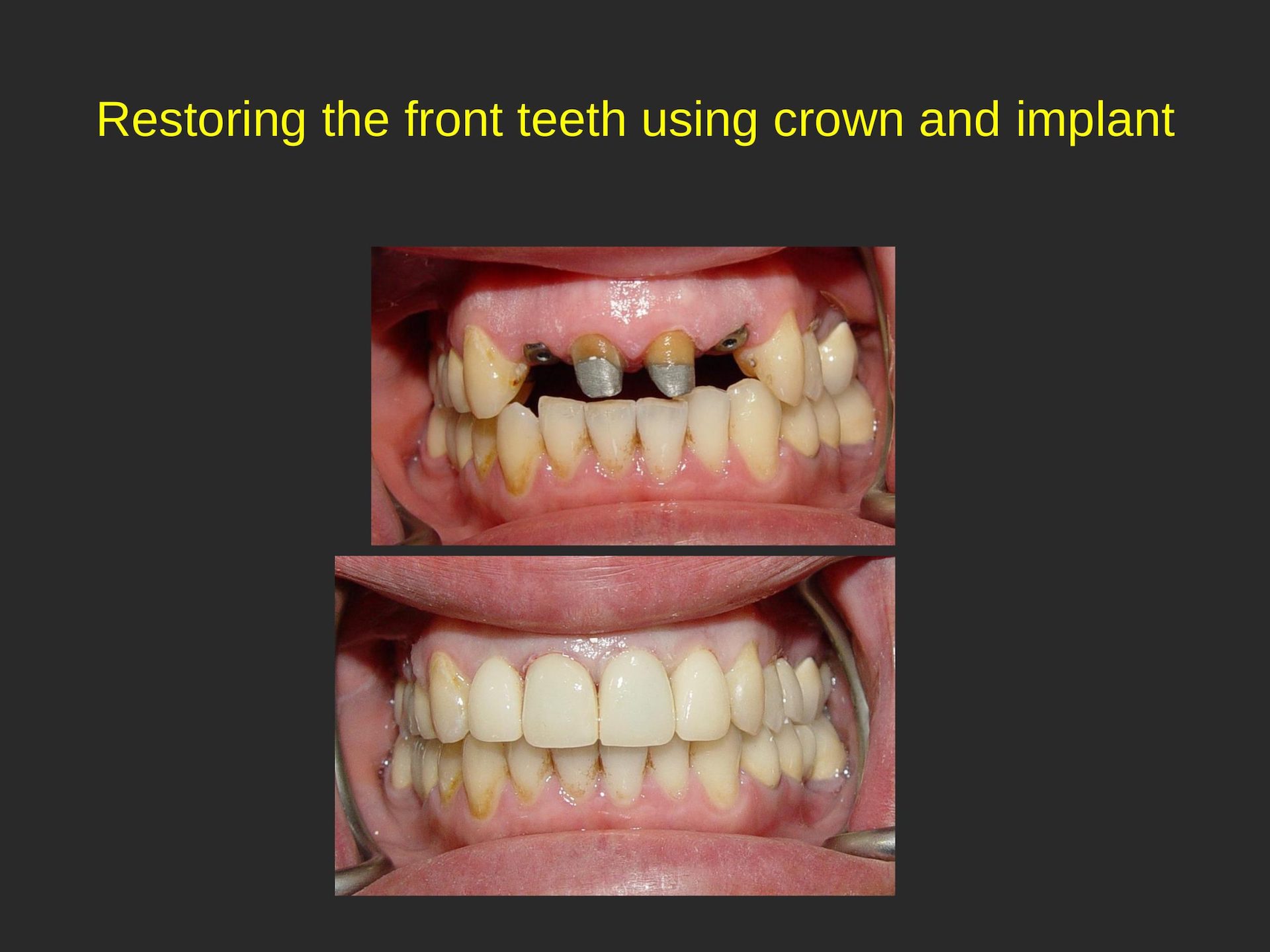 San Jose Pediatric Dentist