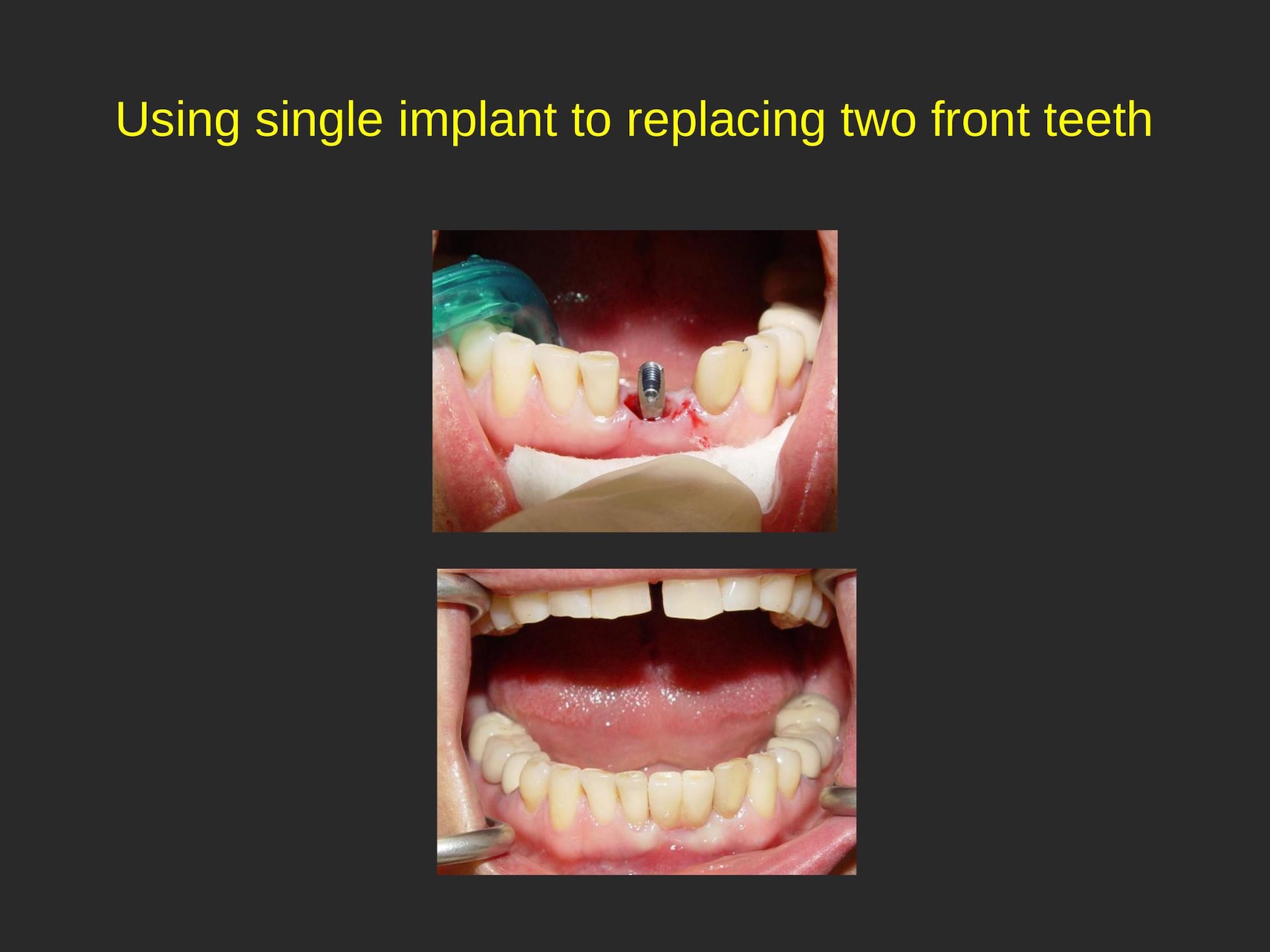 Family Dentist in San Jose