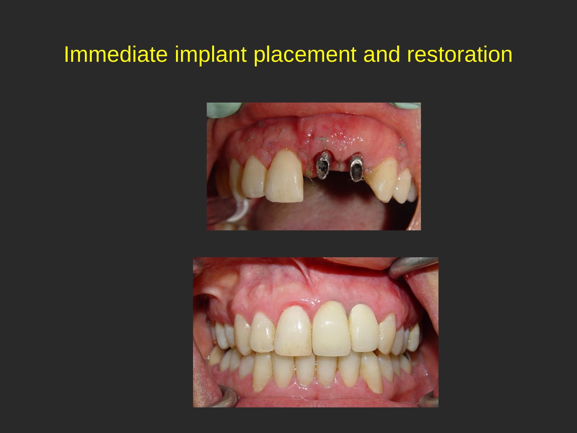 Cosmetic Dental Office in San Jose