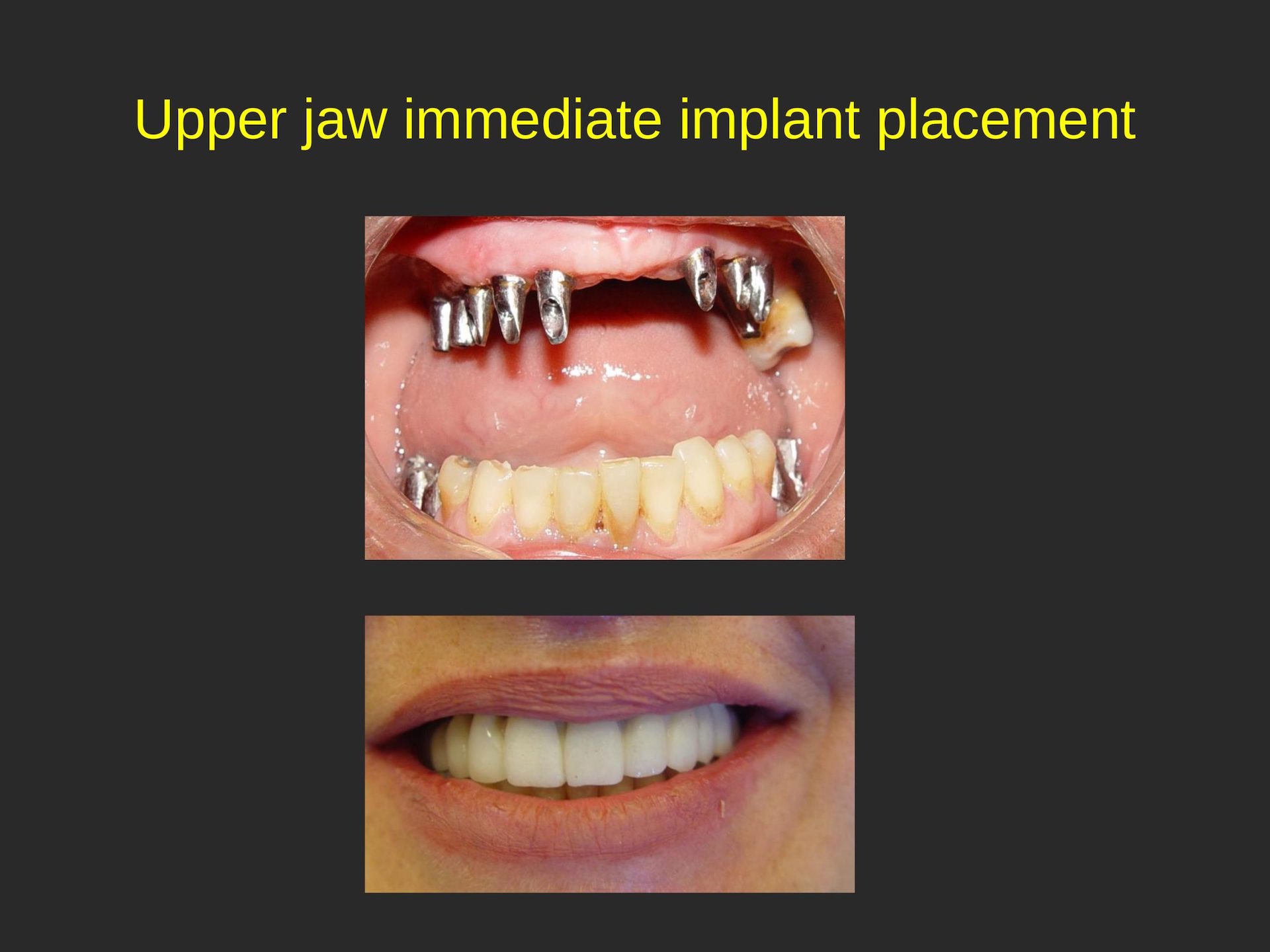 San Jose Cosmetic Dentist