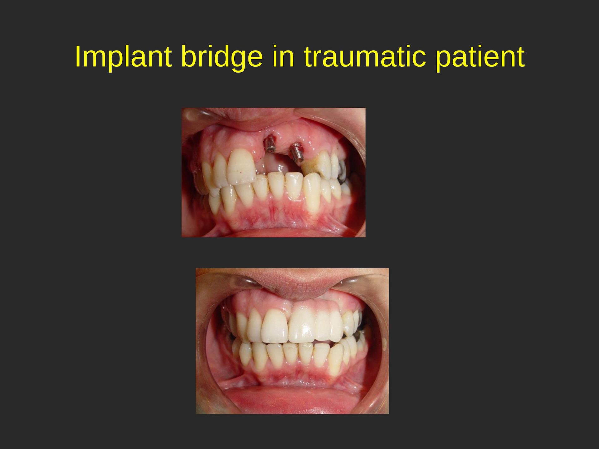 San Jose Pediatric Dentist