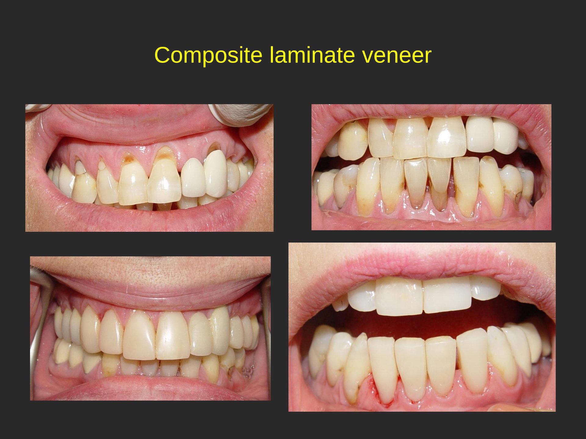 Family Dentist in San Jose