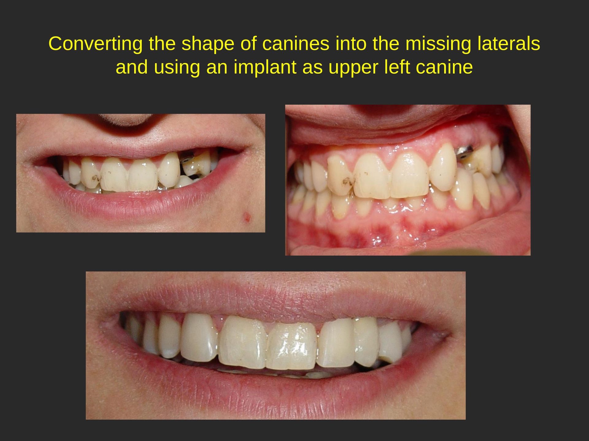 Cosmetic Dental Office in San Jose