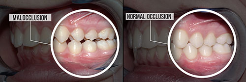 NoblePro Dental | ClearCorrect reg , Botox reg  and Cosmetic Dentistry